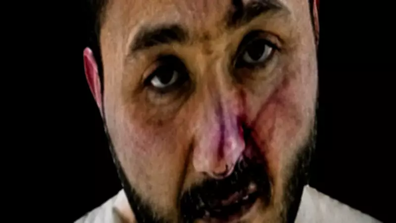 Şehit Polislerin Katil Zanlısı Şizofreni Hastası Çıktı
