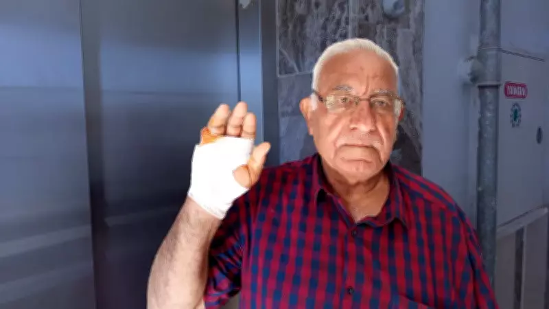 Hatay'da komşu dehşeti: Asansörde parmağını ısırarak kopardı