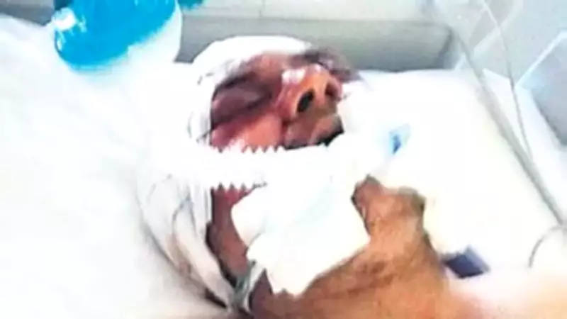 Komşuların Köpek Kavgası Cinayetle Bitti