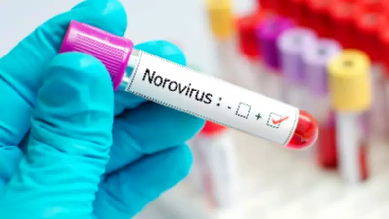 Norovirüs uyarısı: Mide bulantısı ve ani kusmaya dikkat