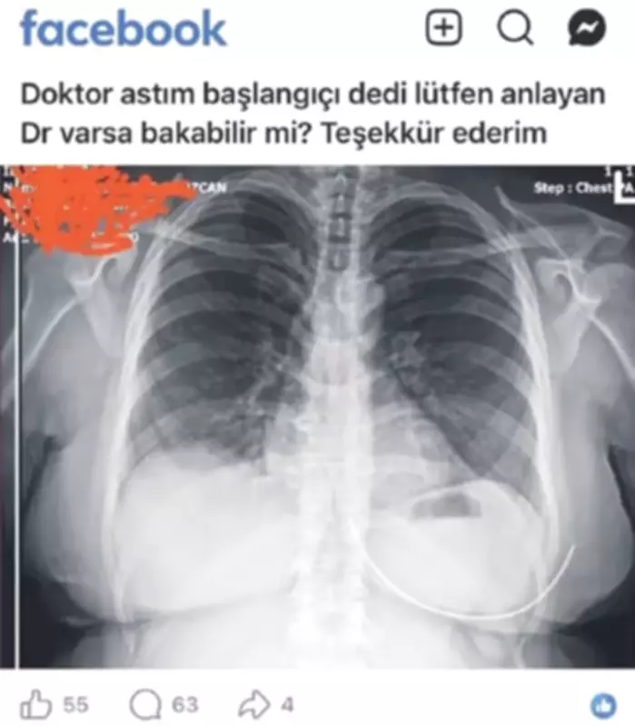 Sanal muayene çılgınlığı: Facebook'tan röntgen paylaşan kadın