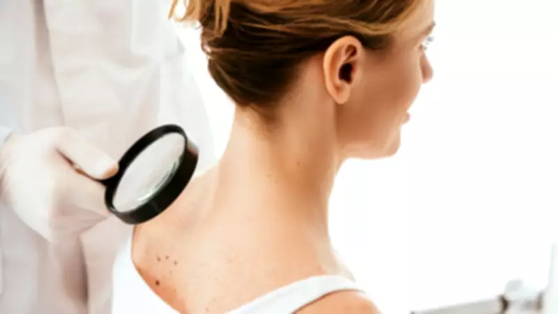 Yaz gelmeden dermatologlardan cilt kanseri uyarısı: Güneş düşündüğünüzden daha tehlikeli