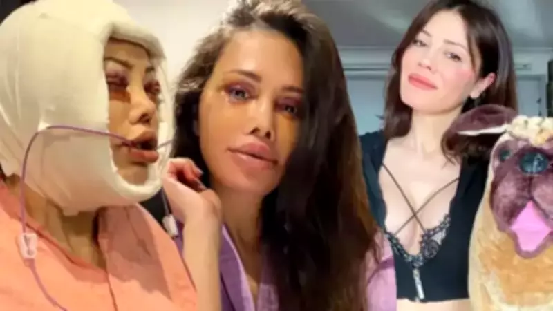 Yüz Nakli Olan Didem Ceran'ın Son Hali Sosyal Medyada Gündem Oldu