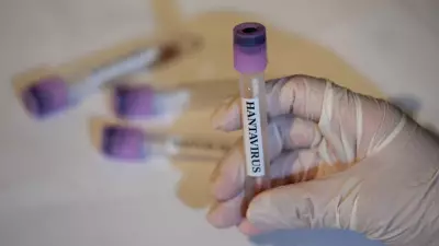 EMA: Hantavirüs İçin Onaylı Tedavi ve Aşı Bulunmuyor