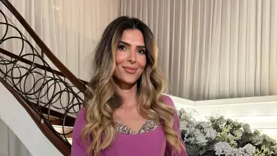 Survivor Merve Aydın'ın estetik sonrası yeni hali şaşkına çevirdi