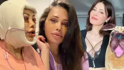 Yüz Nakli Olan Didem Ceran'ın Son Hali Sosyal Medyada Gündem Oldu