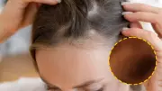 Şampuanın içine sadece 1 kaşık ekleyin! Saçlarınız Rapunzel gibi uzayacak