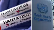 DSÖ: Kongo'da 13 yeni Ebola vakası doğrulandı, hantavirüs riski düşük