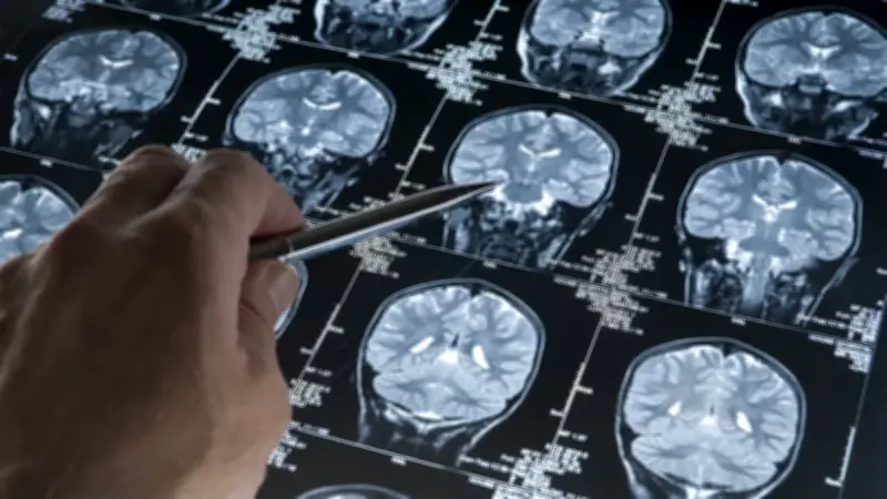 Alzheimer Araştırmalarında Sürpriz Gelişme: Çözüm Bakırda Saklı Olabilir