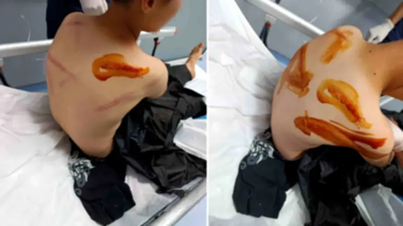 Şanlıurfa'da 11 yaşındaki çocuk sopayla darp edildi, şikayetçi olundu