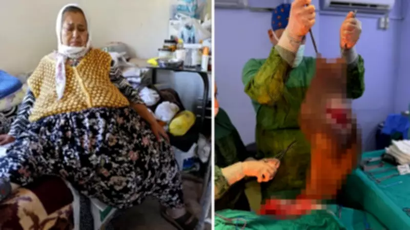 Karnından 40 Kilogramlık Dev Kitle Çıkarılan Kadın Sağlığına Kavuştu