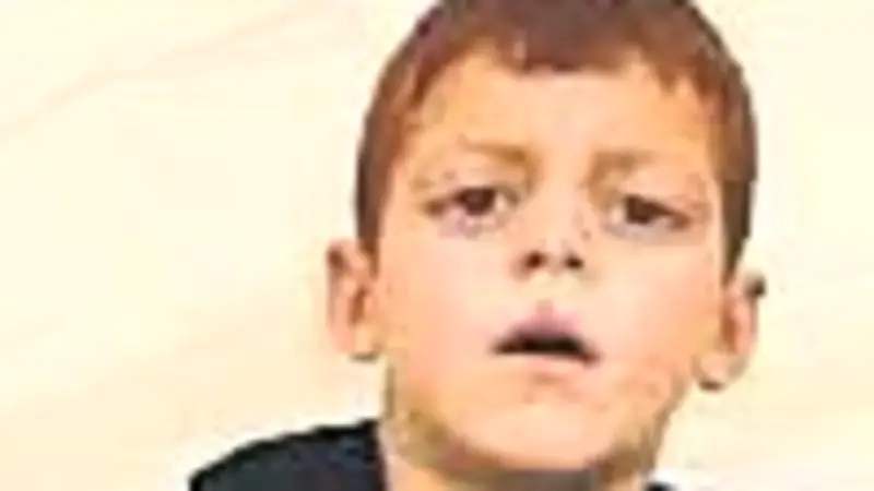 Kırılan Gözlüğüyle İsrail Zulmünü Haykıran Filistinli Çocuk Dünyayı Sarsıyor