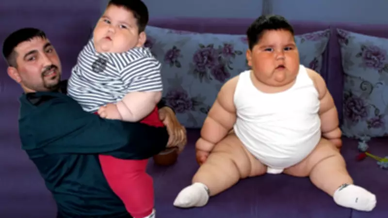 Yağız'ın İnanılmaz Değişimi: 5 Yaşında 90 Kiloydu, Şimdi 40 Kilo