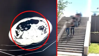 Batman'da Akılalmaz Olay: Midelerinden 353 Parça Uyuşturucu Çıktı