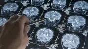 Alzheimer Araştırmalarında Sürpriz Gelişme: Çözüm Bakırda Saklı Olabilir
