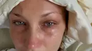 Bella Hadid'den Kötü Haber: Lyme Hastalığıyla Mücadelede Zor Günler