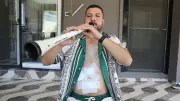 Zurnacı Erman Tosun, ameliyat sonrası nefes egzersizini zurnayla yaptı